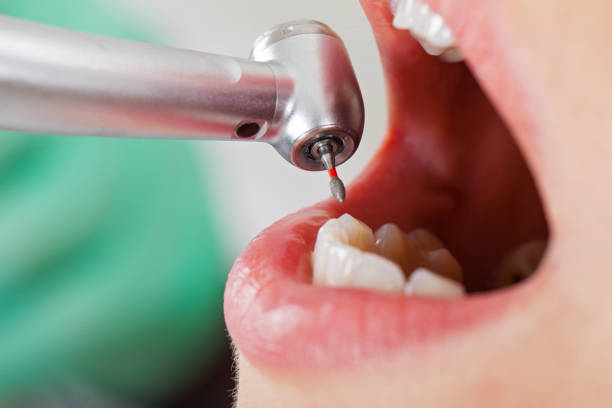 Best Emergency Broken Tooth Repair in Collinsville, OK